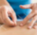 acupuncture points being inserted 