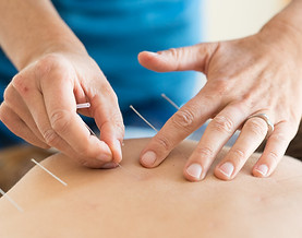 patient receiving acupuncture treatment